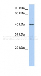 ARP47426_P050 - TMEM144