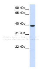 ARP47429_P050 - AGPAT5