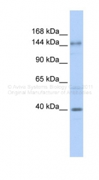 ARP47447_P050 - ADCY10 / SAC