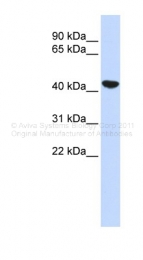 ARP47463_P050 - Cytokeratin 19