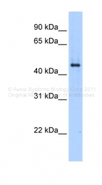 ARP47469_P050 - SERPINE1 / PAI1