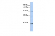 ARP47584_P050 - NCKAP1L / HEM1