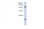 ARP47586_P050 - NCKAP1L / HEM1