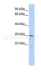 ARP47609_P050 - MORF4