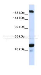 ARP47668_P050 - KIAA1618 / ALO17