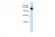 ARP47706_P050 - SCAND3