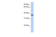 ARP48041_P050 - TMEM173 / STING
