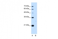 ARP48046_T100 - 14-3-3 protein zeta/delta
