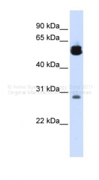 ARP48047_P050 - 14-3-3 protein zeta/delta