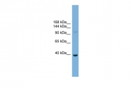 ARP48057_P050 - ST14 / Matriptase
