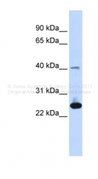ARP48082_P050 - Selenoprotein S (SELS)