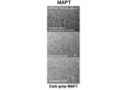 ARP48103_P050 - MAPT / TAU