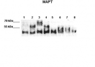 ARP48103_P050 - MAPT / TAU