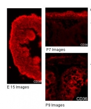ARP48127_P050 - CD36