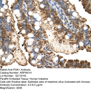 ARP48141_T100 - Phosphoglycerate kinase 1 (PGK1)
