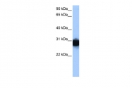 ARP48144_P050 - Triosephosphate isomerase (TPI1)