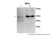 ARP48144_P050 - Triosephosphate isomerase (TPI1)