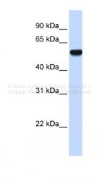 ARP48202_P050 - EEF1A2