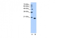 ARP48212_T100 - PEBP1 / RKIP