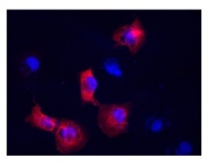 ARP48225_P050 - Vimentin
