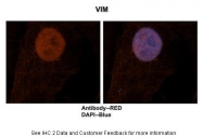 ARP48225_P050 - Vimentin