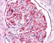 ARP48226_P050 - Vimentin