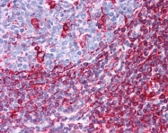 ARP48226_P050 - Vimentin