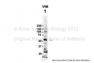 ARP48226_P050 - Vimentin