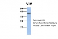 ARP48226_P050 - Vimentin