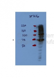ARP48229_P050 - STK16