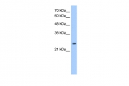 ARP48267_T100 - Peroxiredoxin-6 / PRDX6