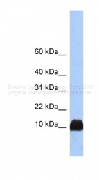 ARP48269_P050 - Profilin-1 / PFN1