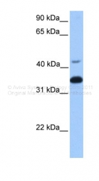 ARP48278_P050 - Transducin beta chain 2 / GNB2