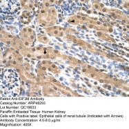 ARP48293_T100 - PCID1 / EIF3M