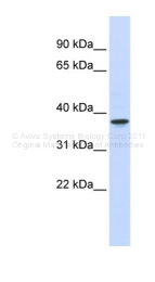 ARP48410_P050 - WDR58 / THOC6