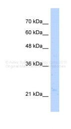 ARP48418_T100 - NUDT16L1 / SDOS