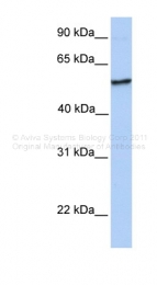 ARP48425_P050 - NUDCD1 / CML66