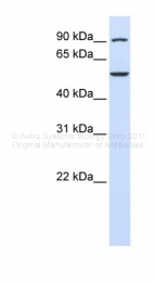 ARP48430_P050 - WDR34