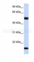 ARP48442_P050 - ADSSL1