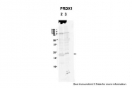 ARP48454_P050 - Peroxiredoxin-1 / PRDX1