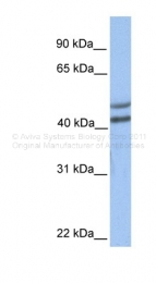 ARP48469_P050 - GALT