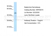 ARP48479_P050 - TAT (Tyrosine aminotransferase)