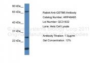 ARP48485_P050 - GSTM5