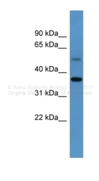 ARP48624_P050 - Glycogenin-1 (GYG1)