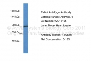ARP48678_P050 - Glycogen phosphorylase muscle form