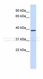 ARP48743_P050 - Glutamyl cyclase / QPCT