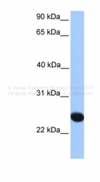 ARP48849_P050 - CSGLCAT