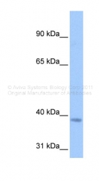 ARP48884_P050 - NSUN3