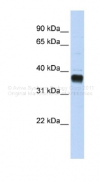 ARP48922_P050 - NUDT18