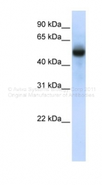 ARP48927_P050 - TRMT2B